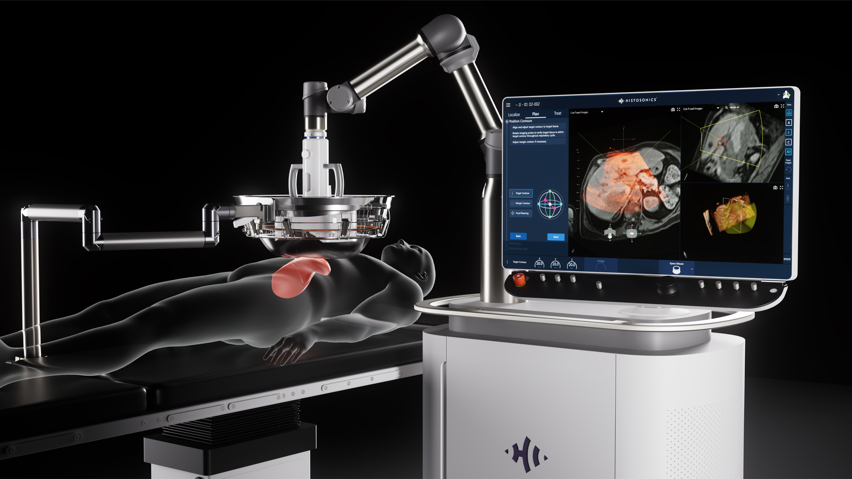 Meet Edison: Non-invasive tumor destruction