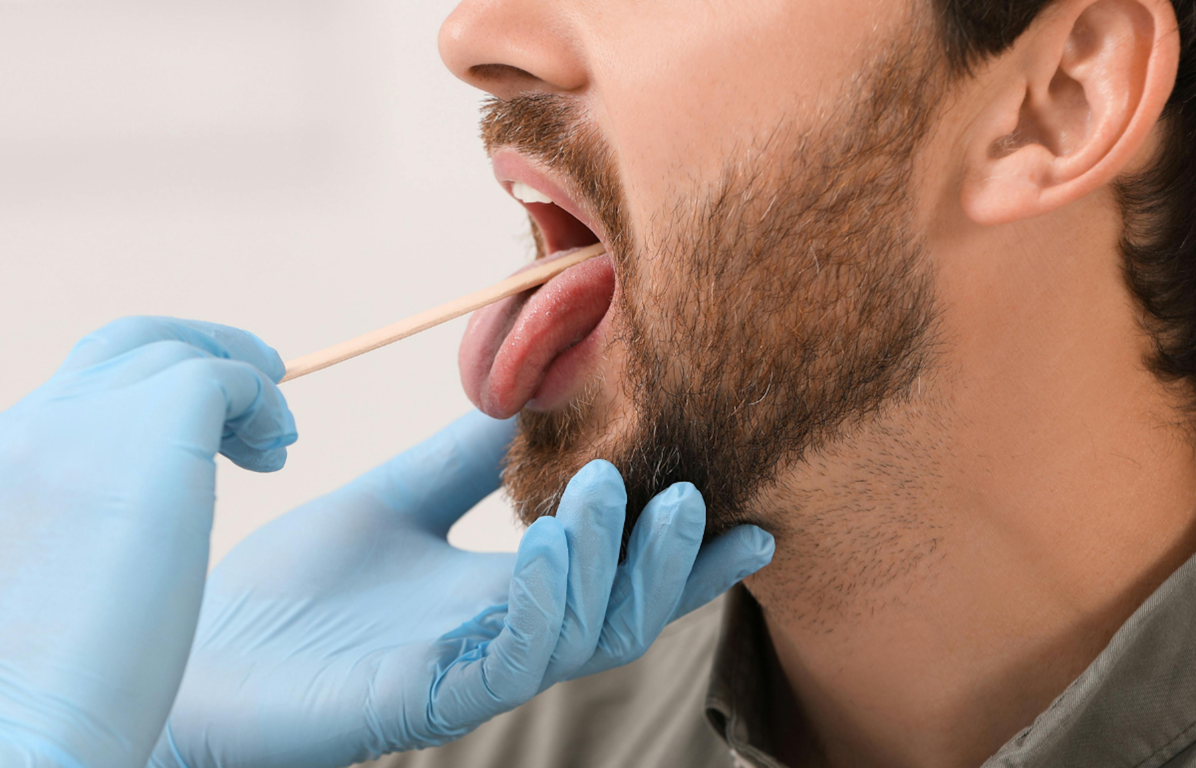 A doctor examines a man's oral cavity