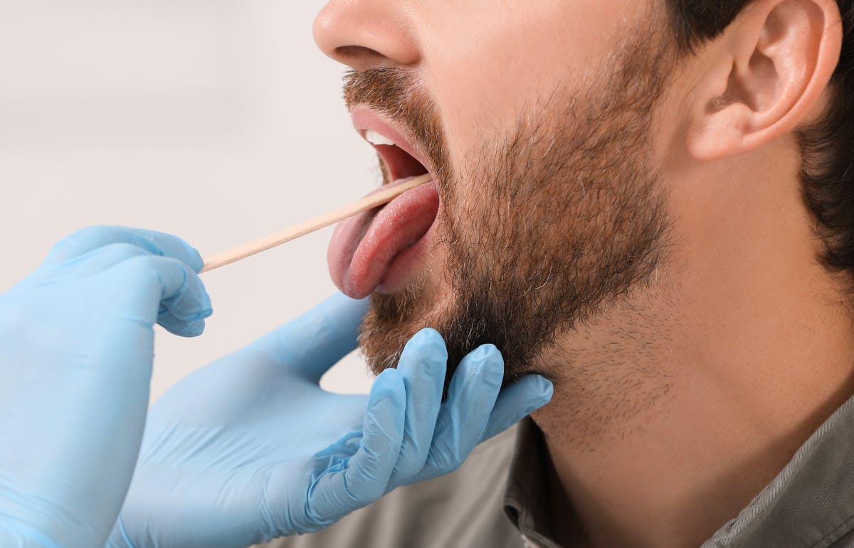 A doctor examines a man's oral cavity