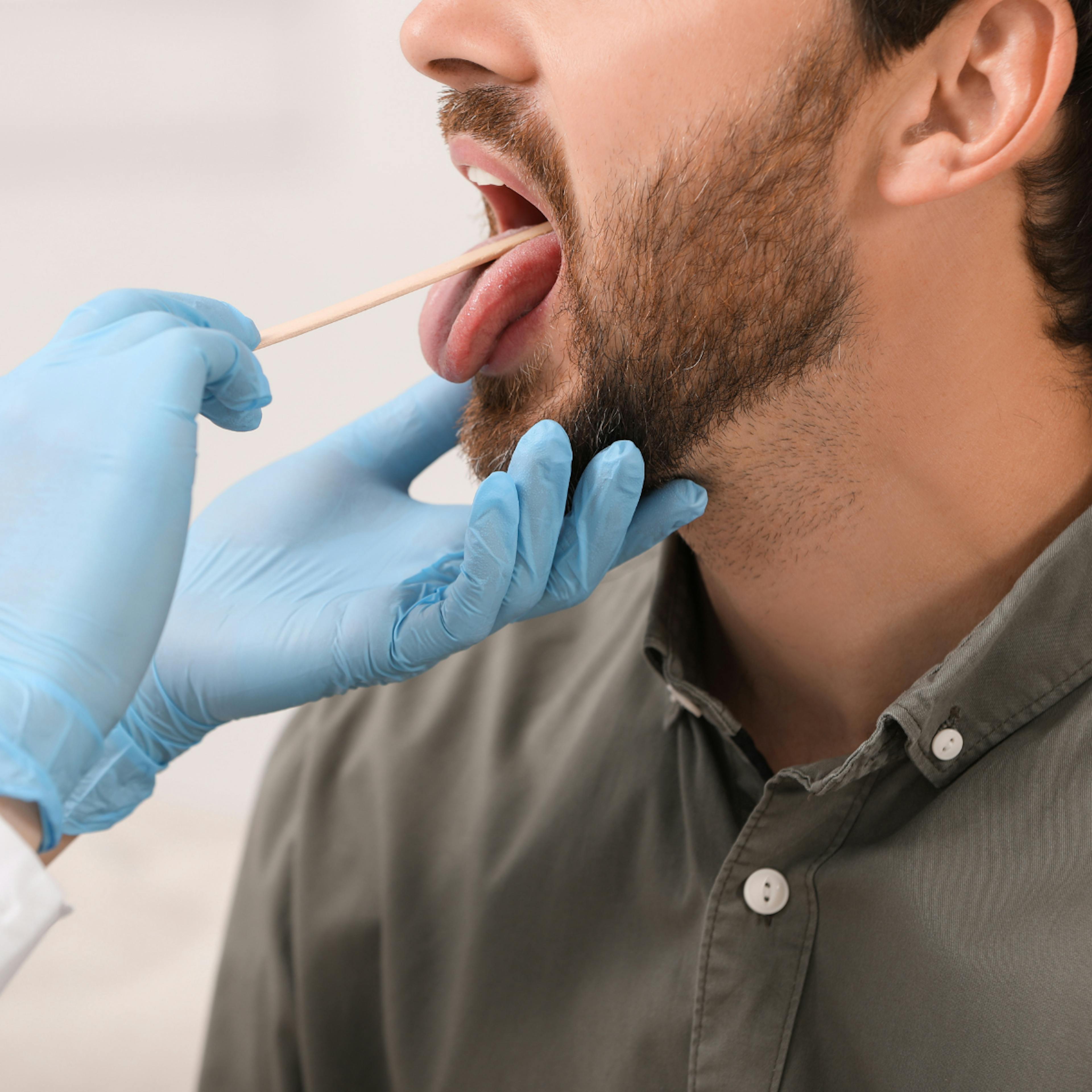 A doctor examines a man's oral cavity