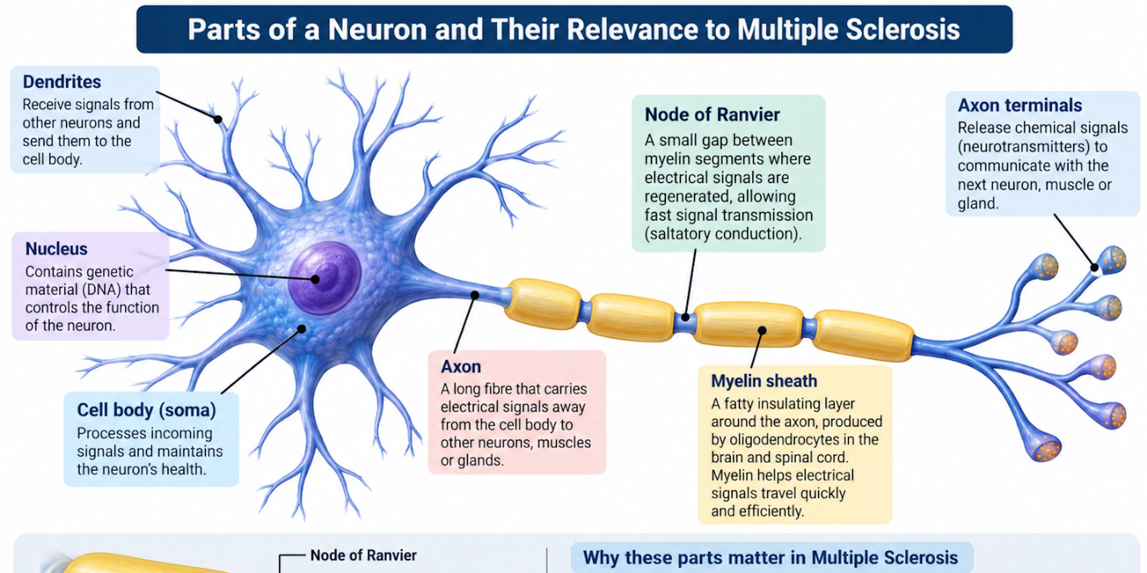 Parts of a neuron (dendrites, cell body, axon, myelin sheath, nodes of Ranvier, axon terminals) and why they matter in multiple sclerosis