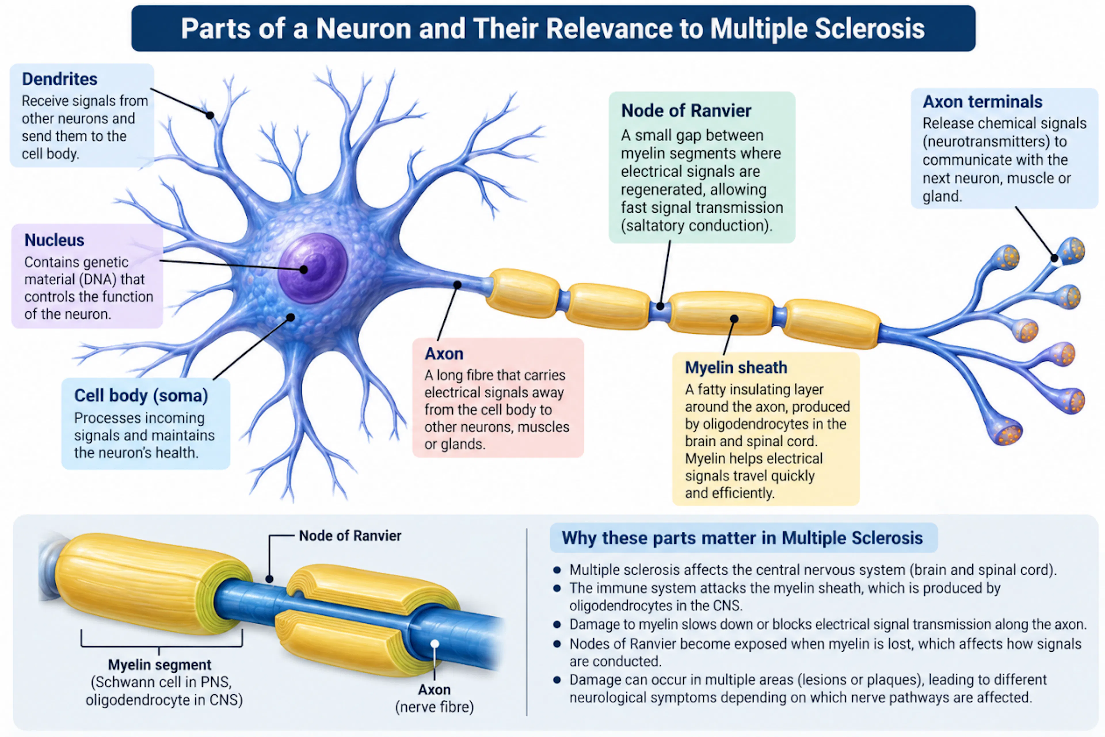 Parts of a neuron (dendrites, cell body, axon, myelin sheath, nodes of Ranvier, axon terminals) and why they matter in multiple sclerosis