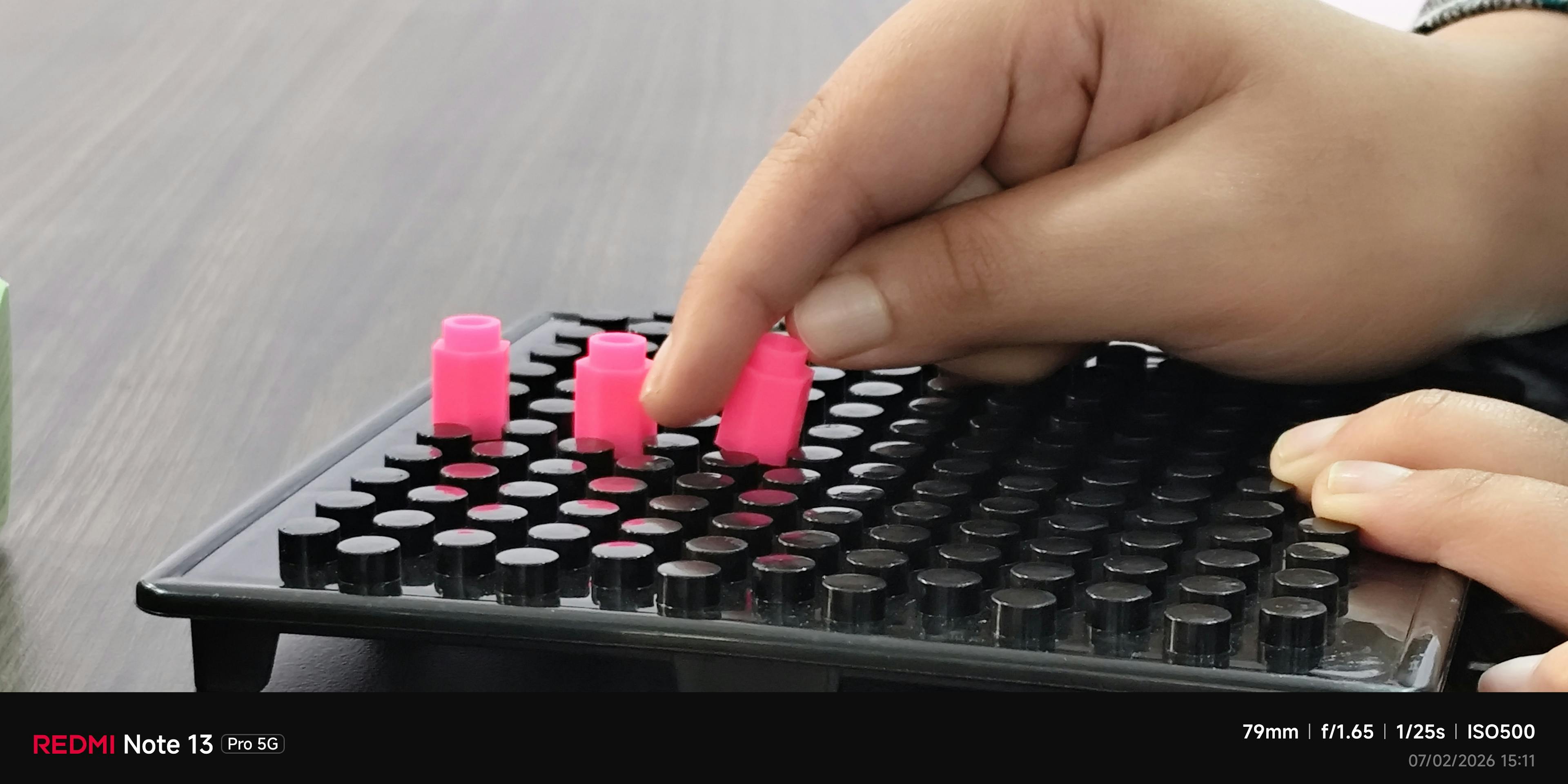 Occupational Therapy for Traumatic Brain Injuries Helps Recovery