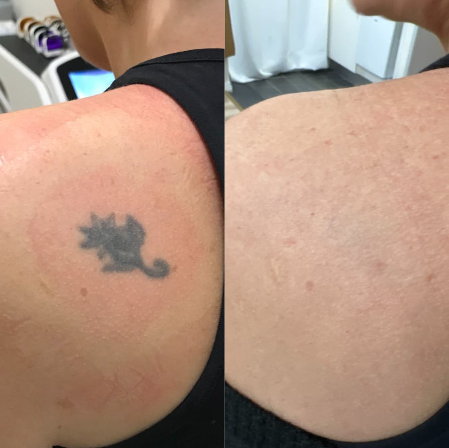 Tattoos When You Get Older: A Surprising Truth