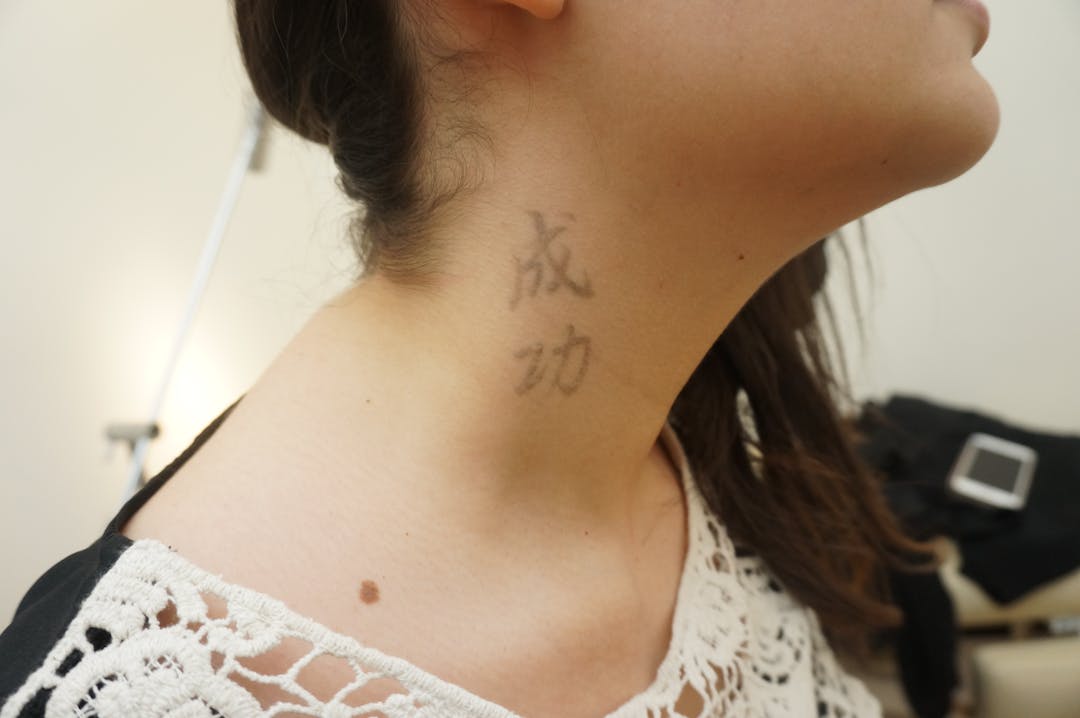 tatuering hals före