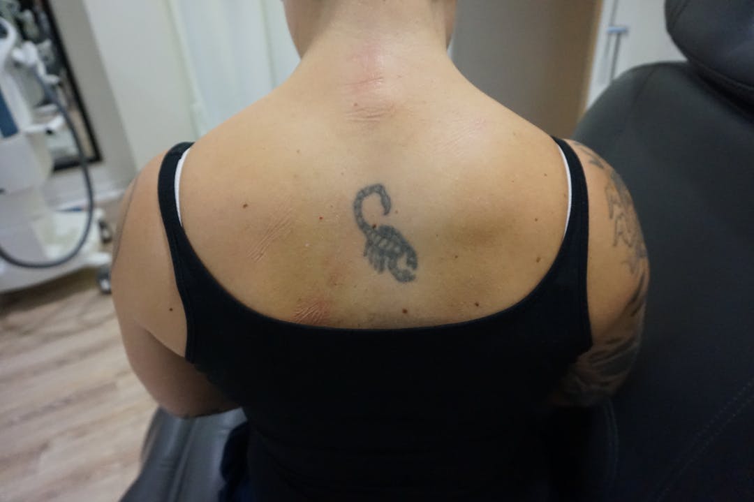 tatuering skorpion före