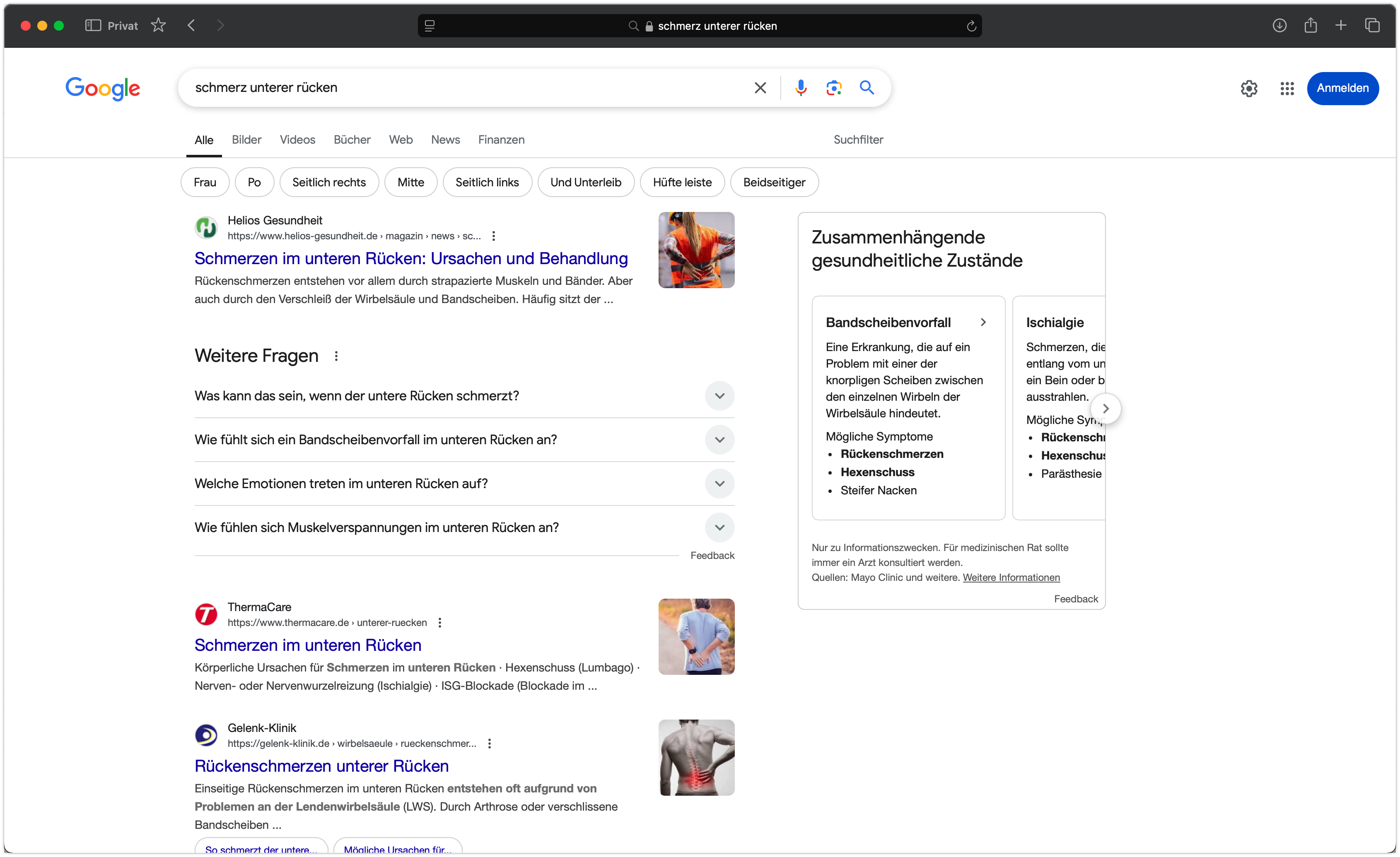 SEO-Performance des neuen Helios Gesundheitsportals.