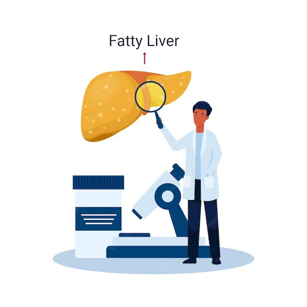 Fatty liver and obesity connection