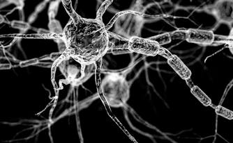 alzheimer's disease and sleep - image of brain neurons