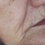 Wrinkles before using divine secret serum