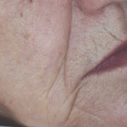 Wrinkles after using divine secret serum