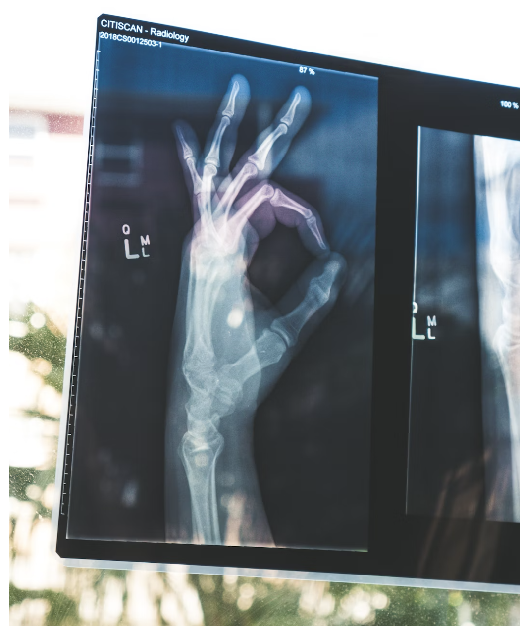 TLDR; Innovations: The Use of 3D Printing in the Medical Field