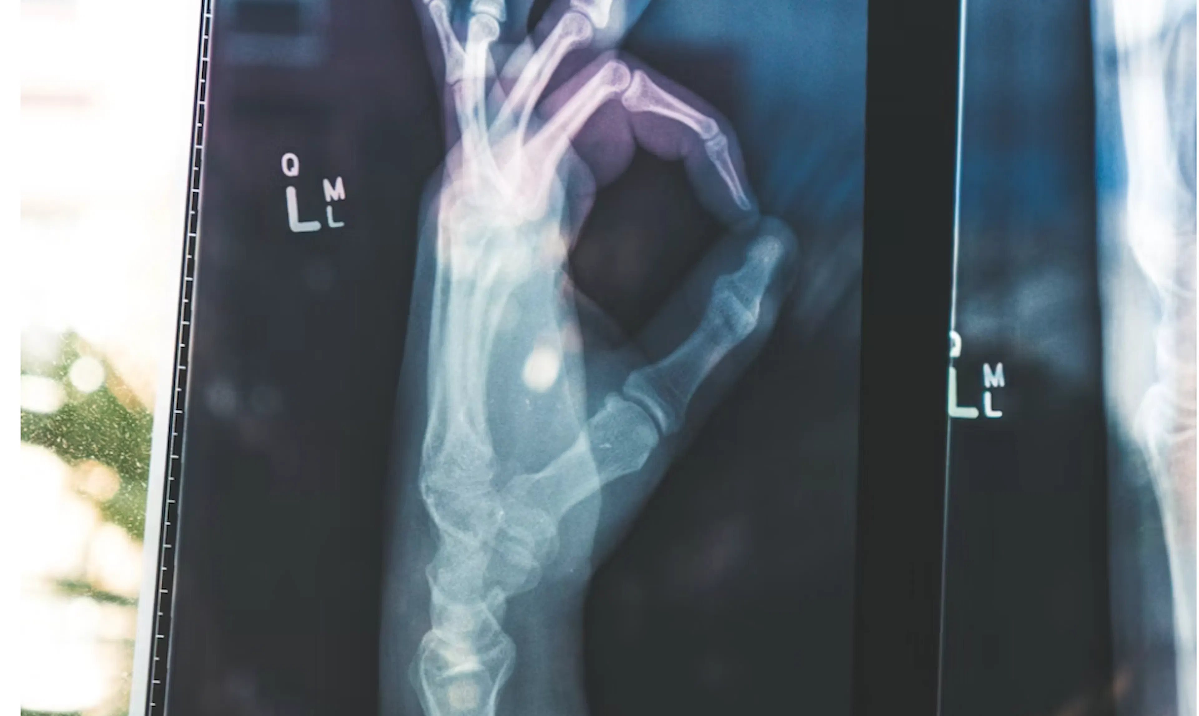 TLDR; Innovations: The Use of 3D Printing in the Medical Field