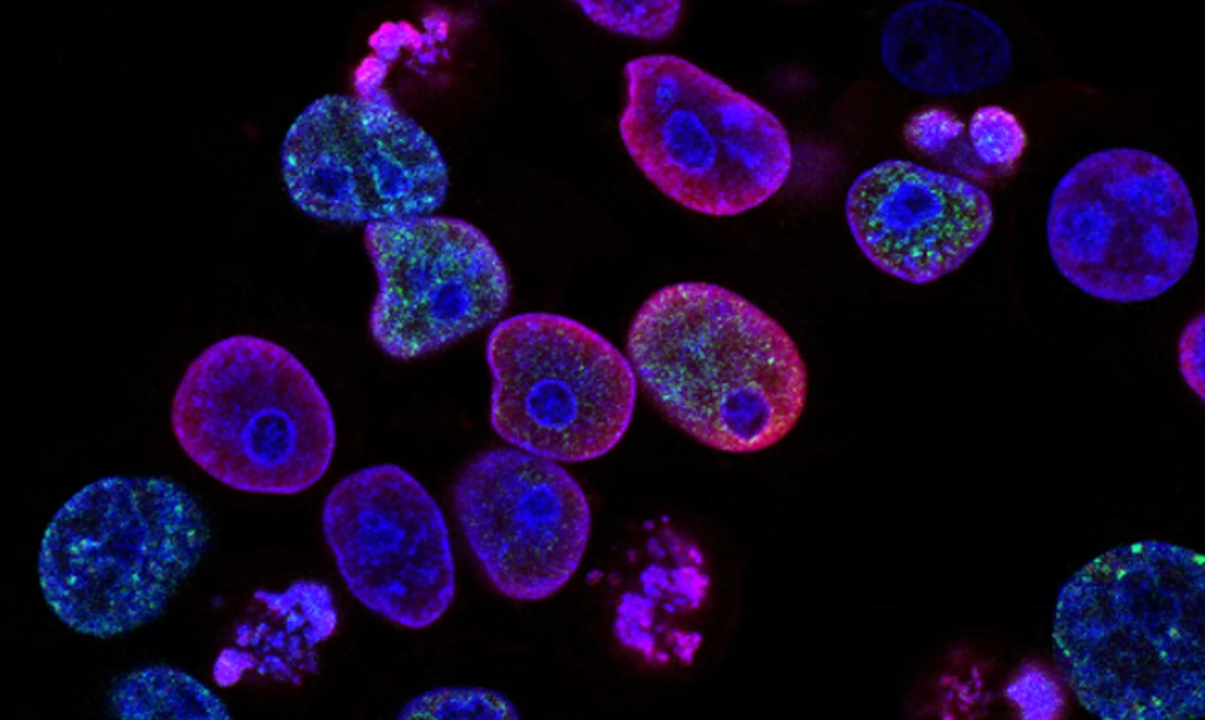 TL;DR Science: Oncogenes