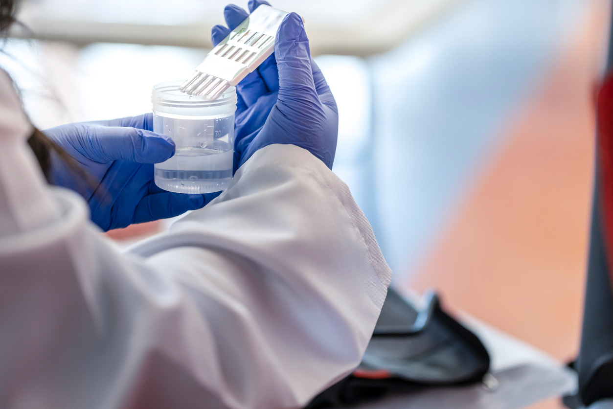 Random Drug Testing at Work: Rights & Compliance - ScoutLogic