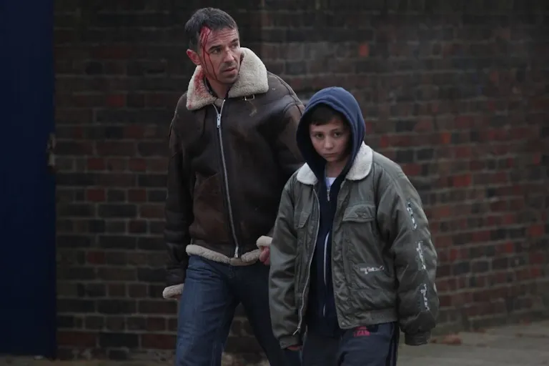 A white man with a wound on his head with blood dripping down walking with a young white boy