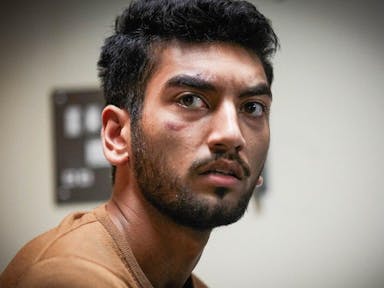 A young British Asian man with cuts on his face looking affronted