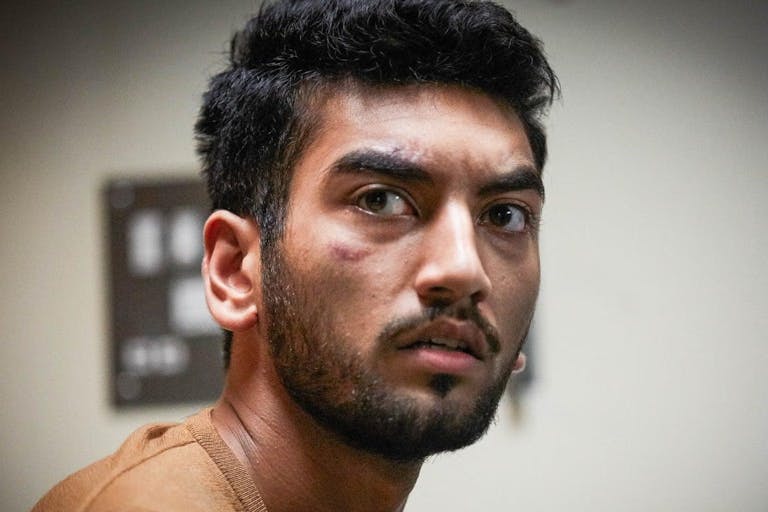 A young British Asian man with cuts on his face looking affronted