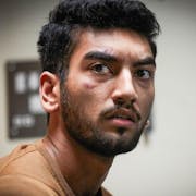 A young British Asian man with cuts on his face looking affronted