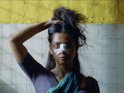 A young Indian woman in a dark sari holding her hair up in a messy bundle with a big bandage across her nose
