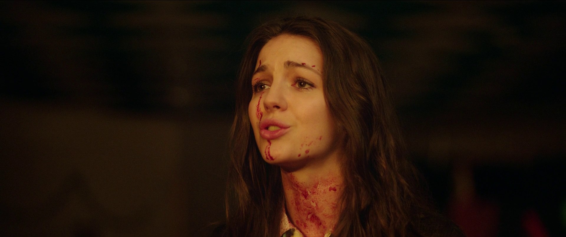 A white woman with blood on her face.