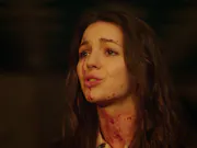 A white woman with blood on her face.