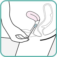 Vaginal - Rotate Swab