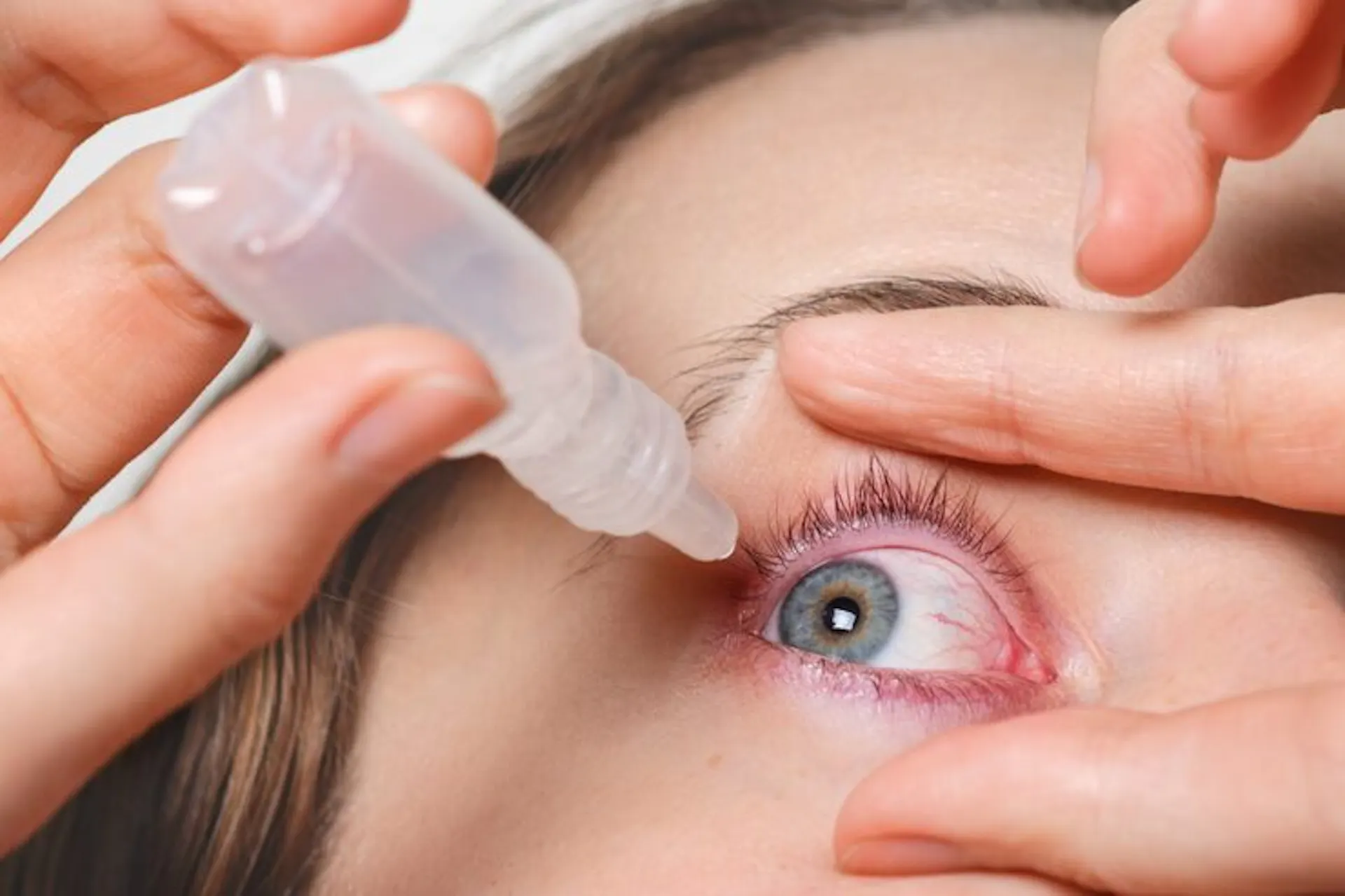 Diabetic Eye Disease