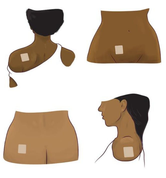 Where to put the Evra patch