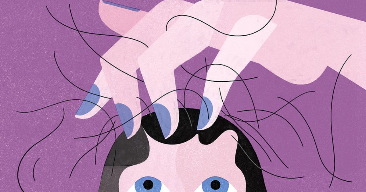 Guide to Female Pattern Baldness (Androgenic Alopecia): Causes, Symptoms and Treatments in Singapore