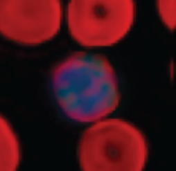 Sight Diagnostics Basophil