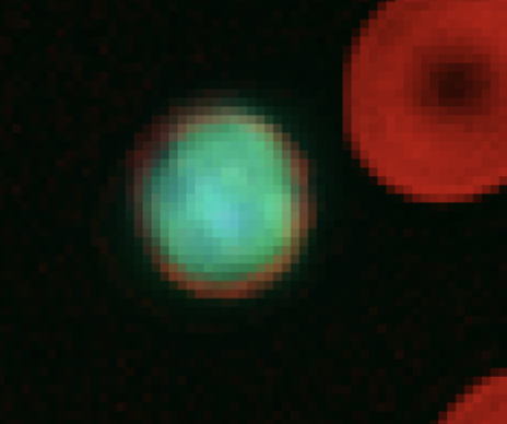 Lymphocytes | Sight Diagnostics