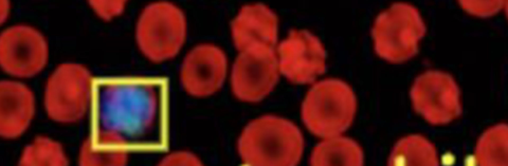 What is Absolute Neutrophil Count (ANC) and How is it Measured in Blood Tests?