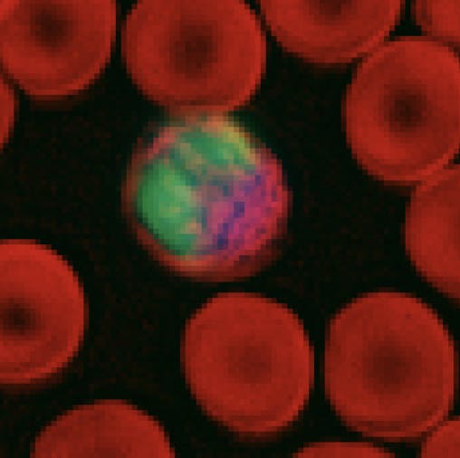 Eosinophils Sight Diagnostics