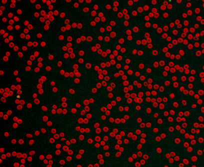 Sight Diagnostics Complete Blood Count