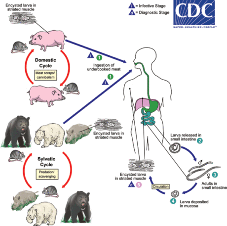 Trichinosis Graphic