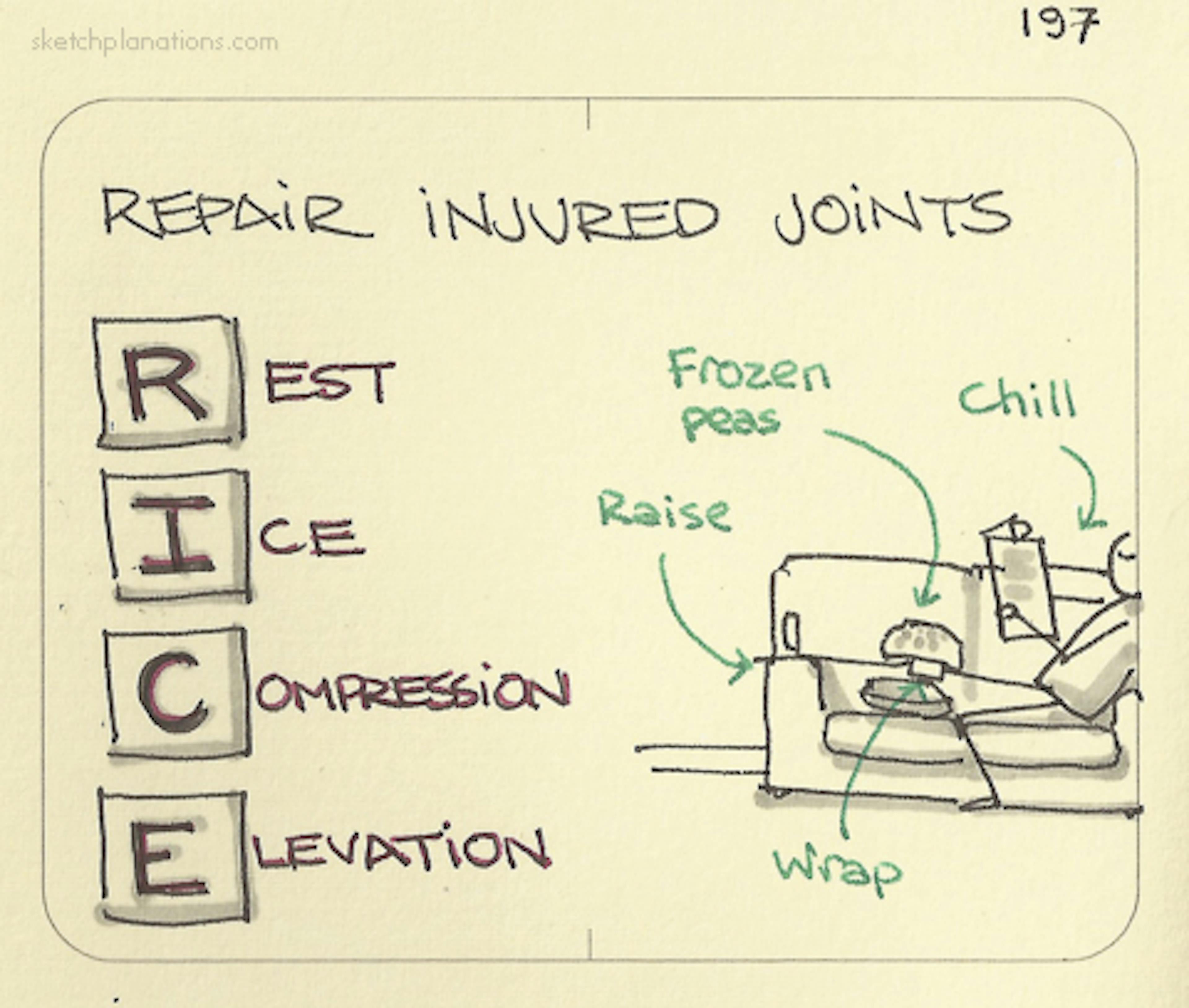 What is the RICE acronym for repairing injured joints: Rest, Ice, Compression, Elevation