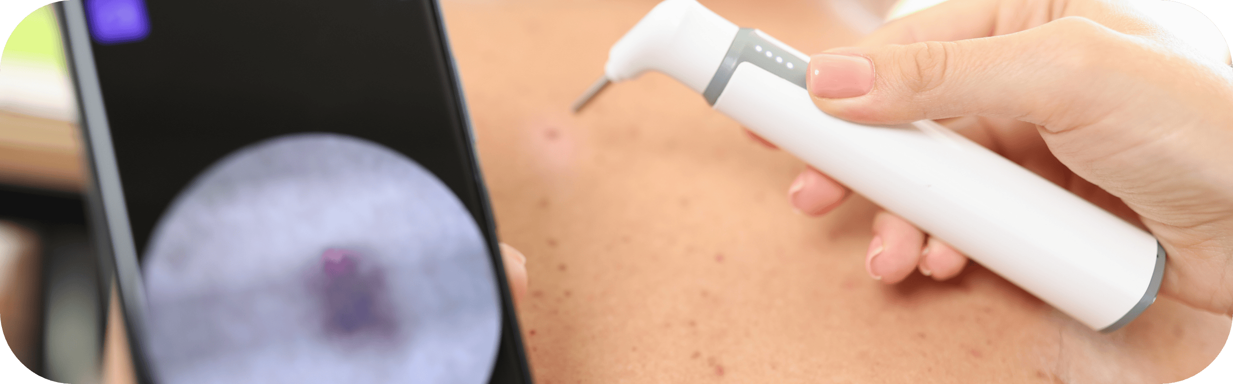 man having his mole scanned