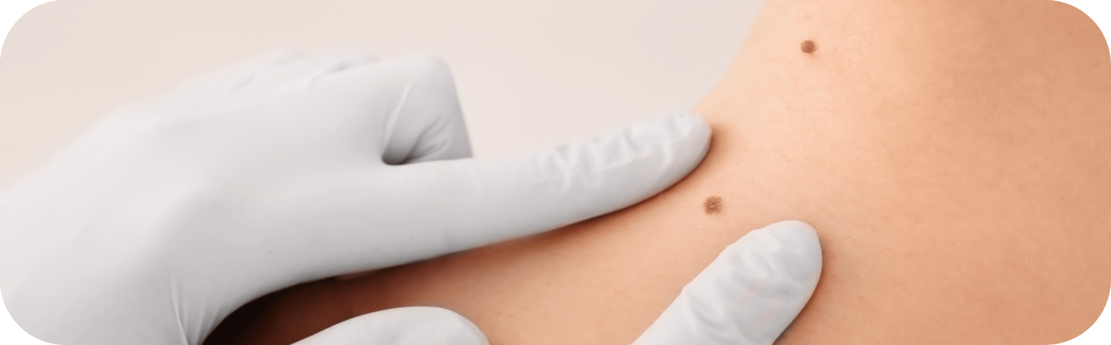 woman having her moles examined