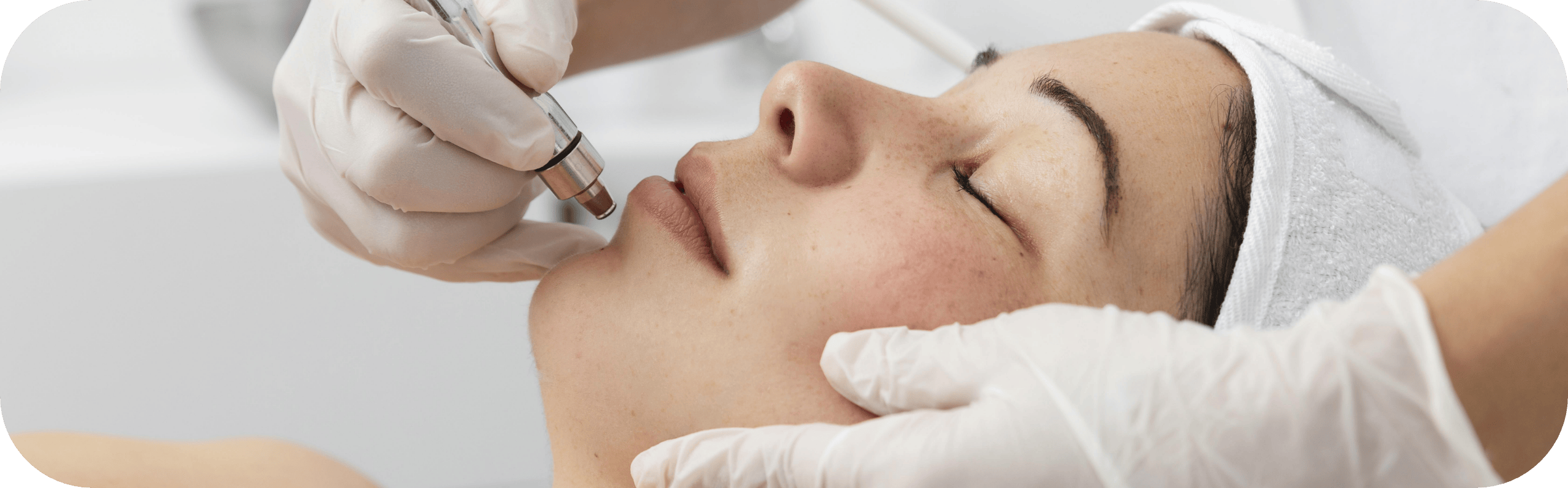 woman having skin microneedling
