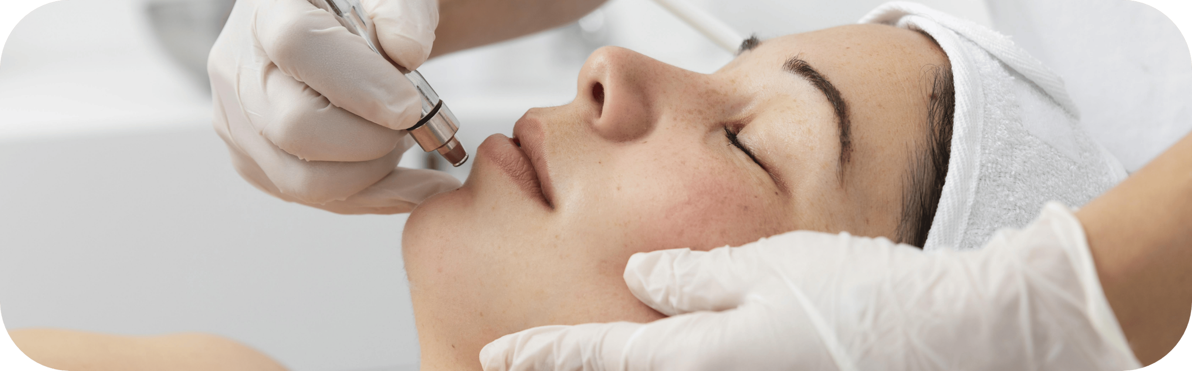 woman having skin microneedling