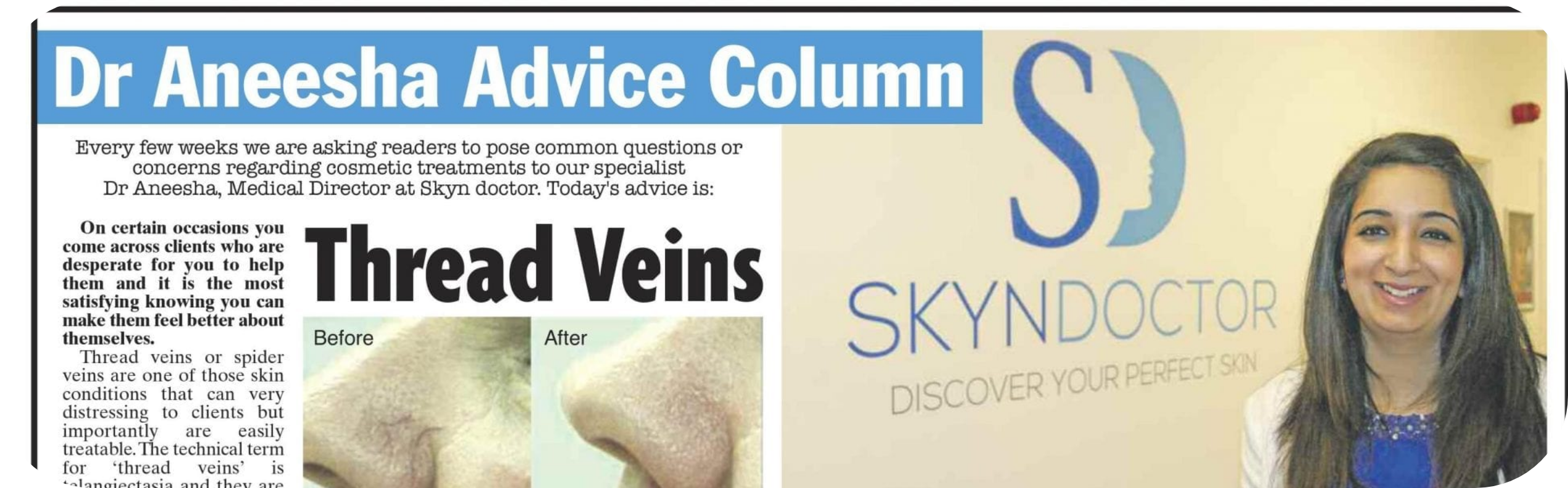 Facial Thread Vein Treatments | Skyn Doctor Blog