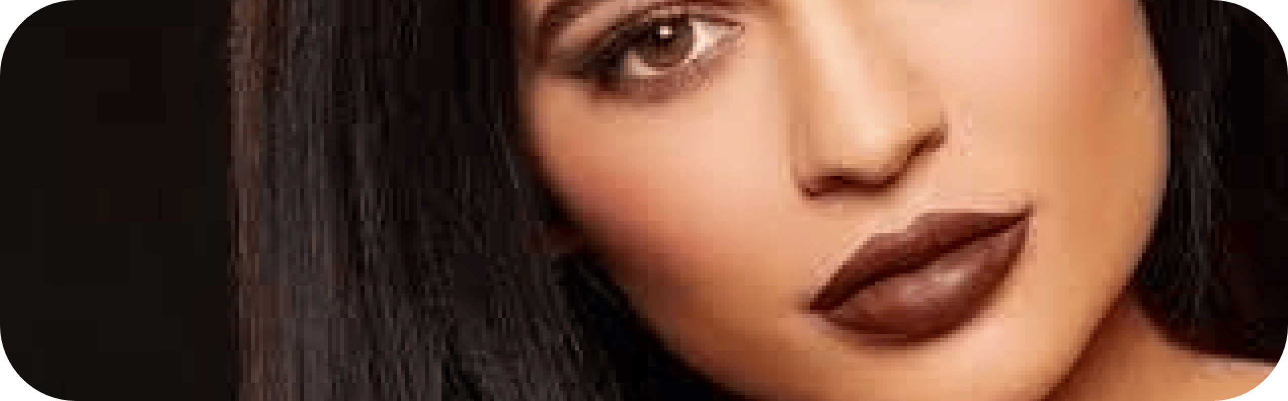 Womans face after lip filler treatment