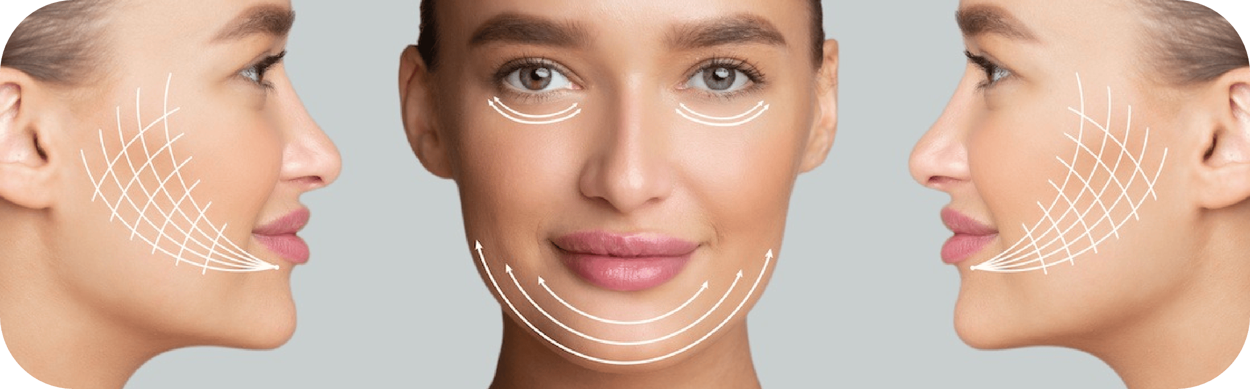 non-surgical facelift
