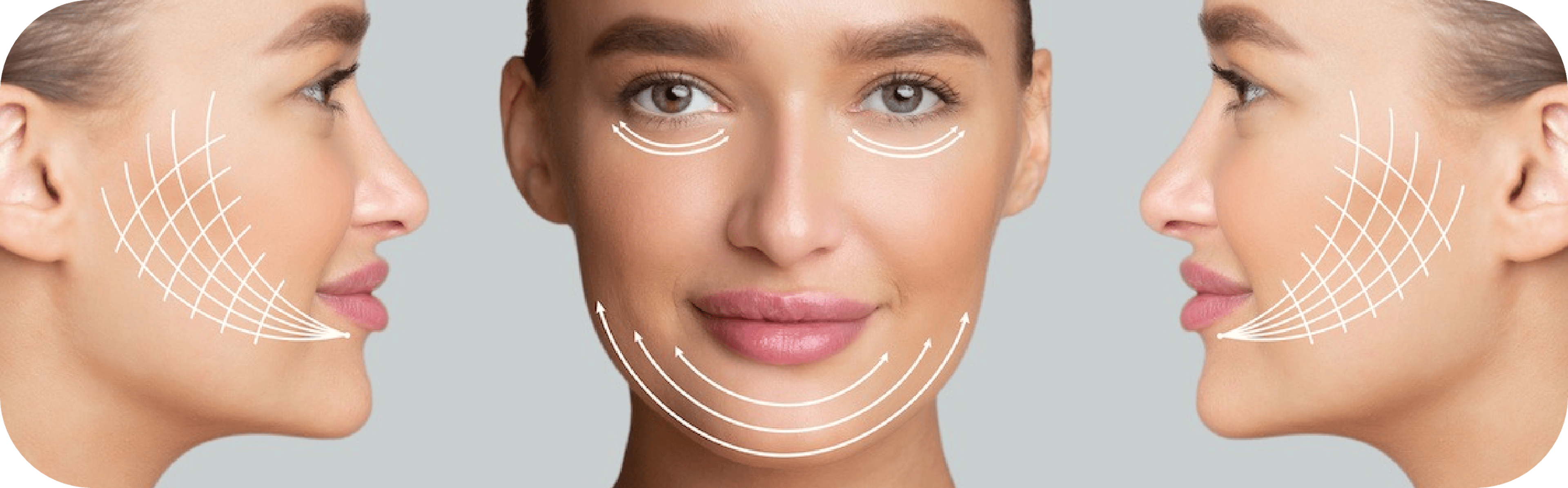 non-surgical facelift