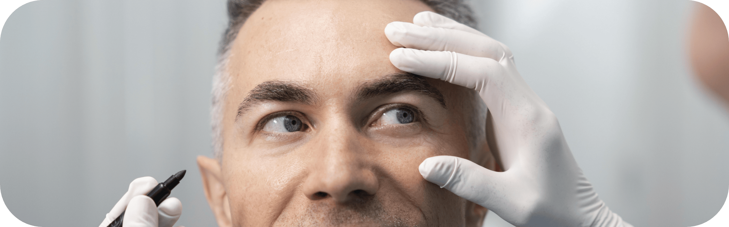 man having tear trough treatment