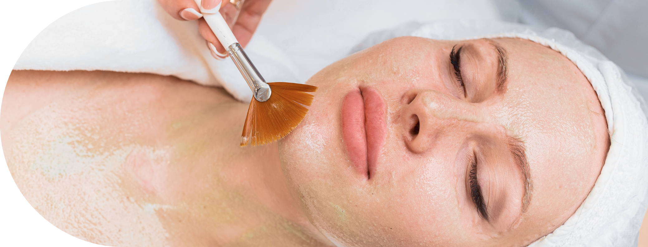Woman having Mesopeel treatment