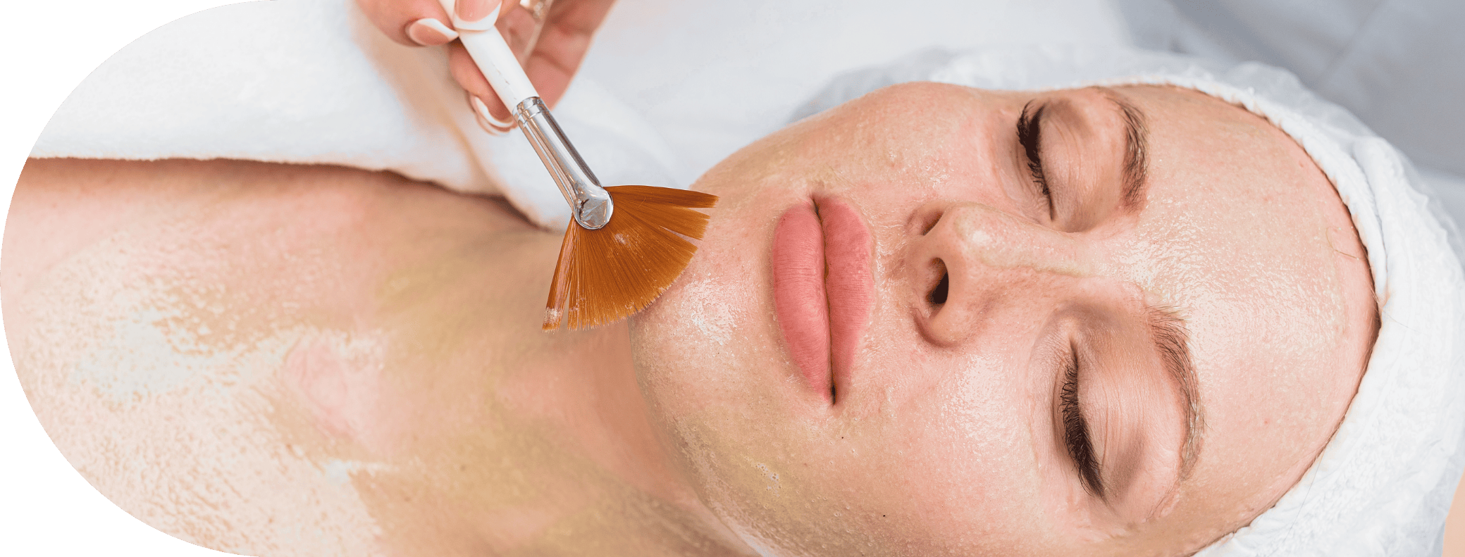 Woman having Mesopeel treatment