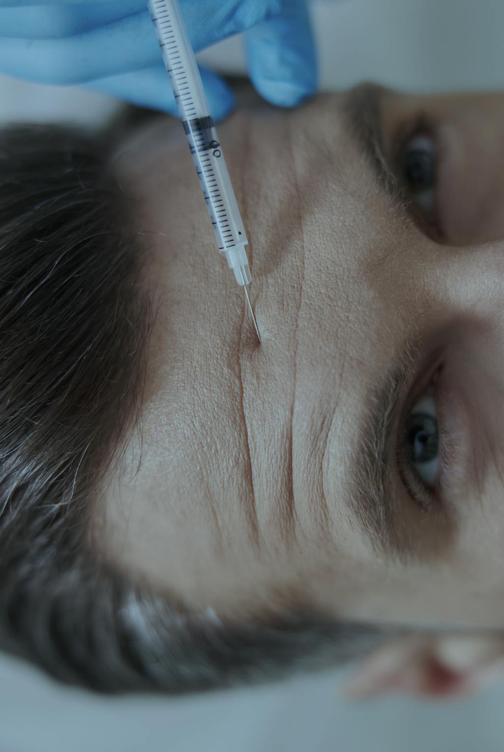 Anti Wrinkle treatments