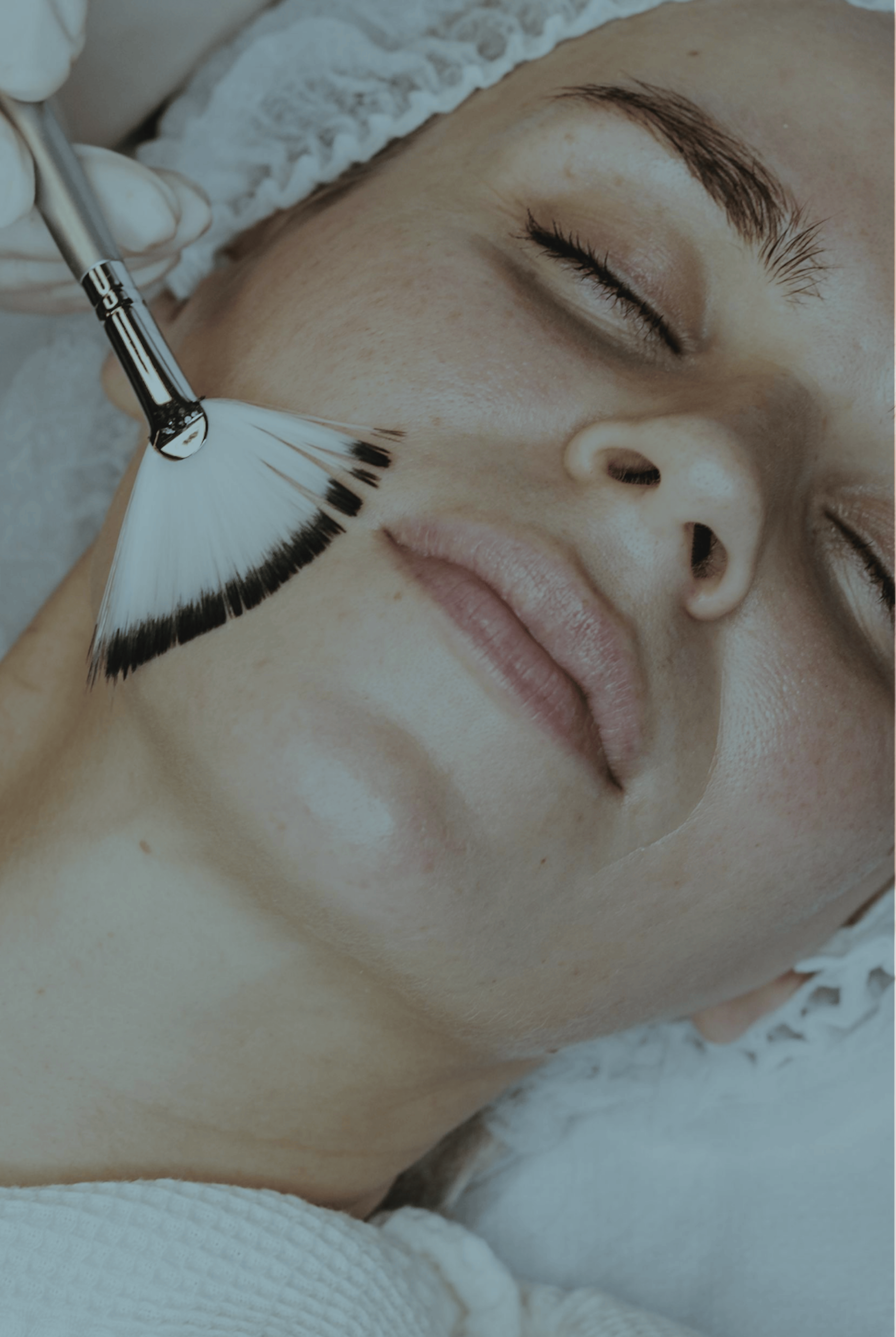Mesopeel treatment